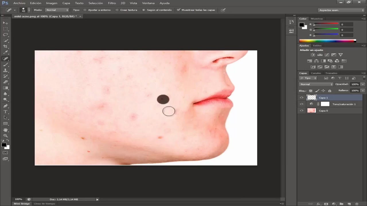 click en imperfecciones